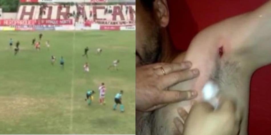 Disparos en Argentina