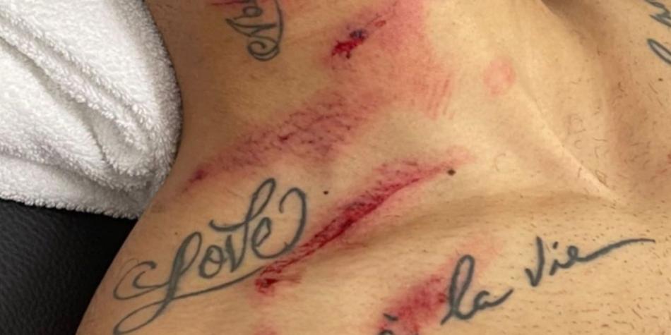 Cuello de Matheus Cunha