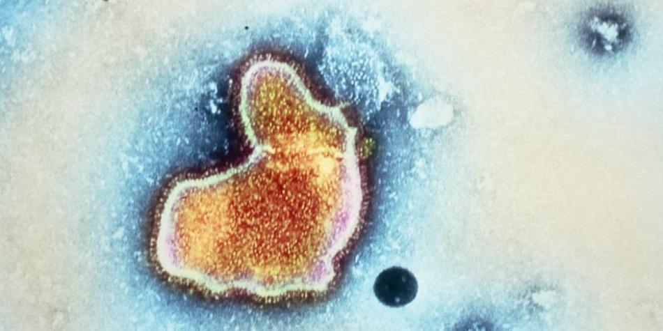 BBC Mundo: Imagen del virus VRS