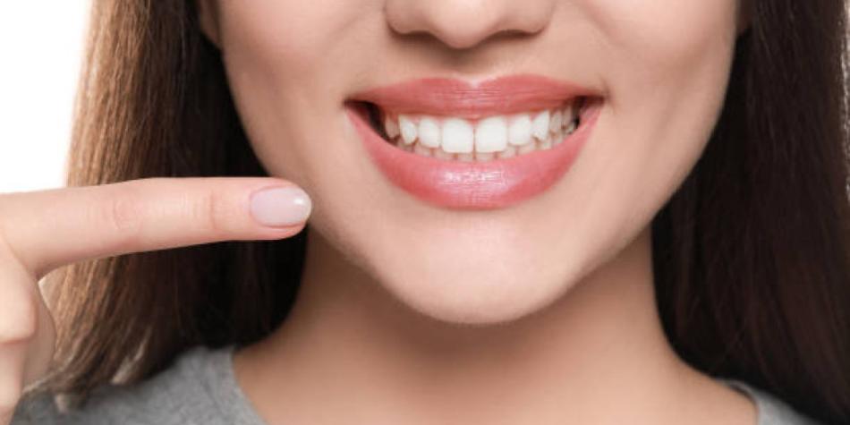 Dientes